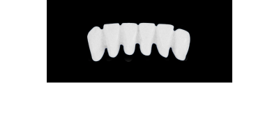 Ref.E12+E12 f Lower Anterior :  1x  white wax veneer-bridge, (33-43), carved to fit over its compatible yellow hollow pontic block-frame, (32-42) , both SMALL, for porcelain pressed to metal bridgework